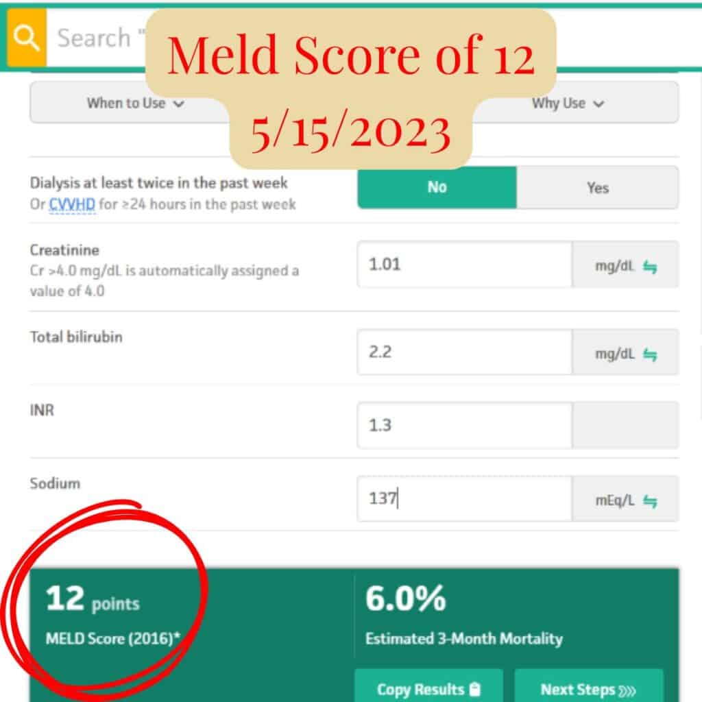 Screenshot showing Scott’s MELD score of 12 from May 15, 2023, indicating continued improvement and stabilization of liver function.