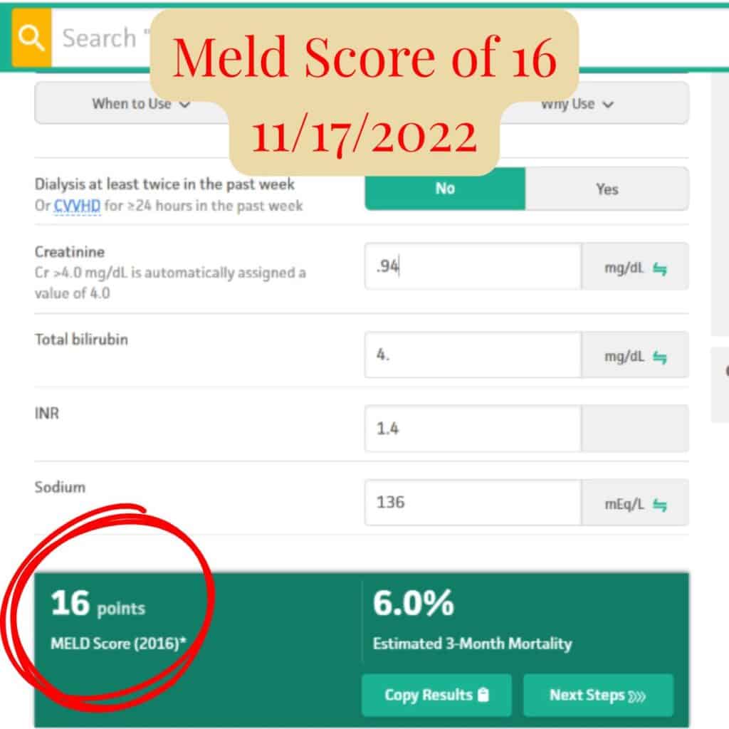 Screenshot showing Scott’s MELD score of 16 from November 17, 2022, indicating continued improvement in liver disease recovery.