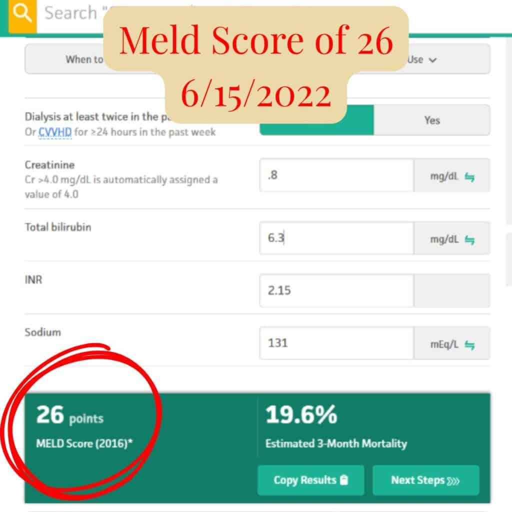 Screenshot showing Scott’s MELD score of 26 from June 15, 2022 during advanced liver disease
