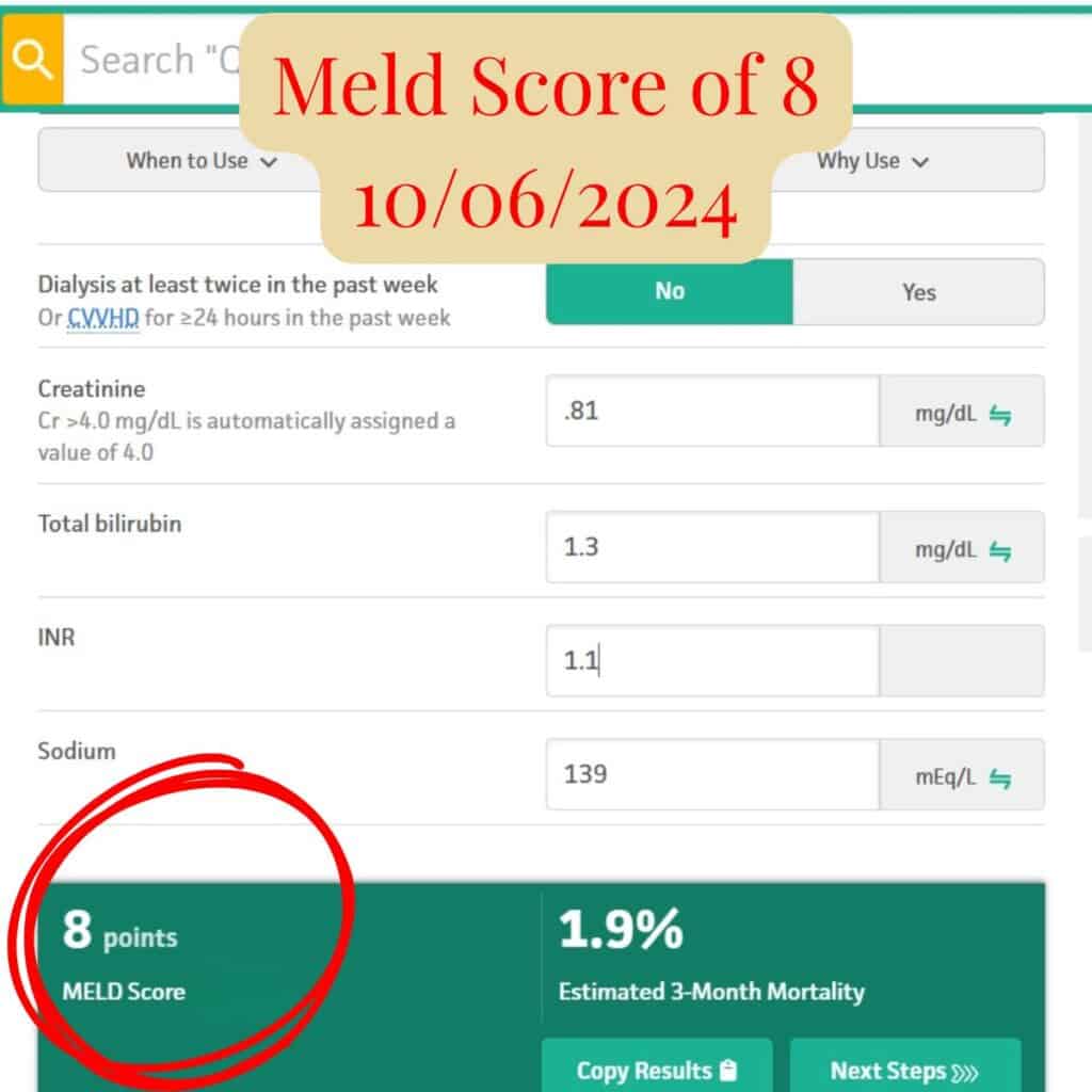 Screenshot showing Scott’s MELD score of 8 from October 6, 2024, reflecting sustained recovery and excellent liver function.